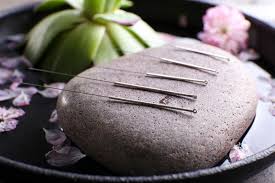 Acupuncture Acupuncture