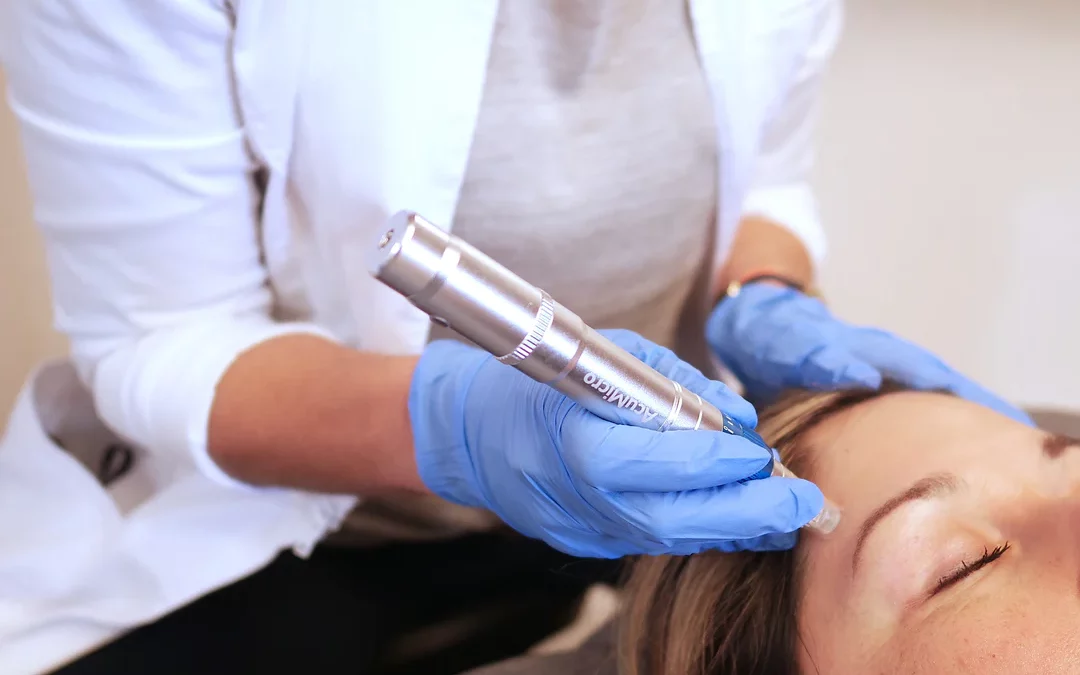 Micro- Needling Facial Rejuvenation